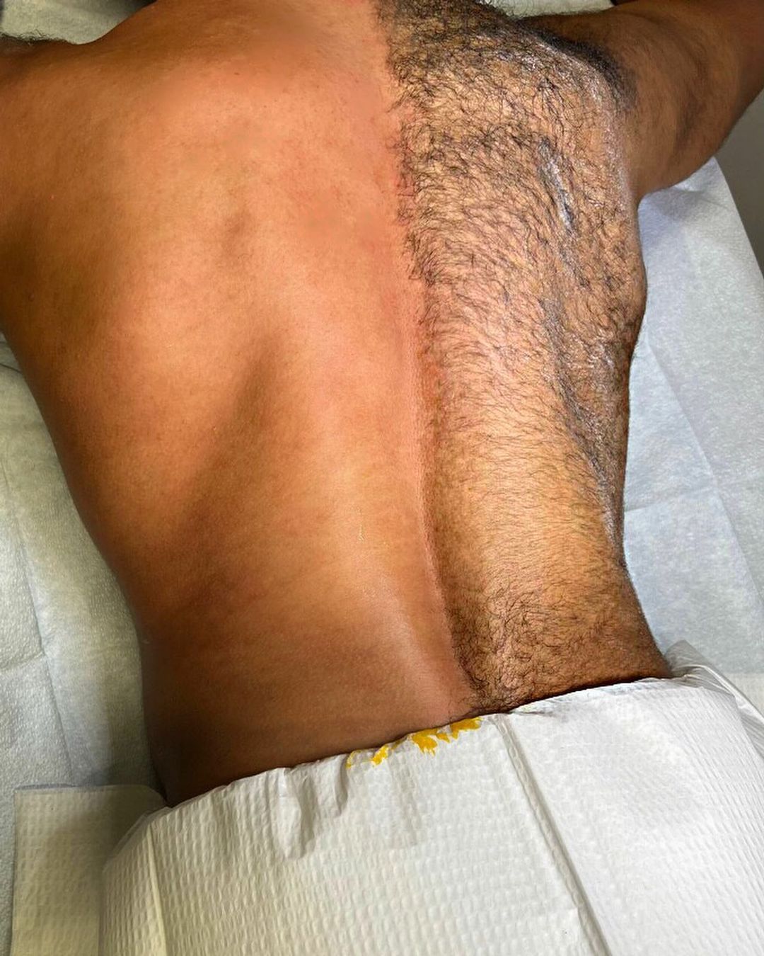 Side-by-side before-and-after results of a full back wax.